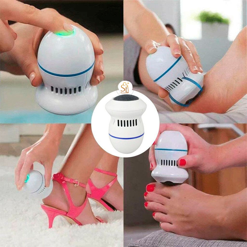 ✨ Removedor Eléctrico de Callos – Pies Suaves e Impecables en Minutos ✨